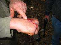 Brian McArdle's freshly bloodied hand