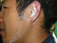 Yong Wang, after being shot in the ear
